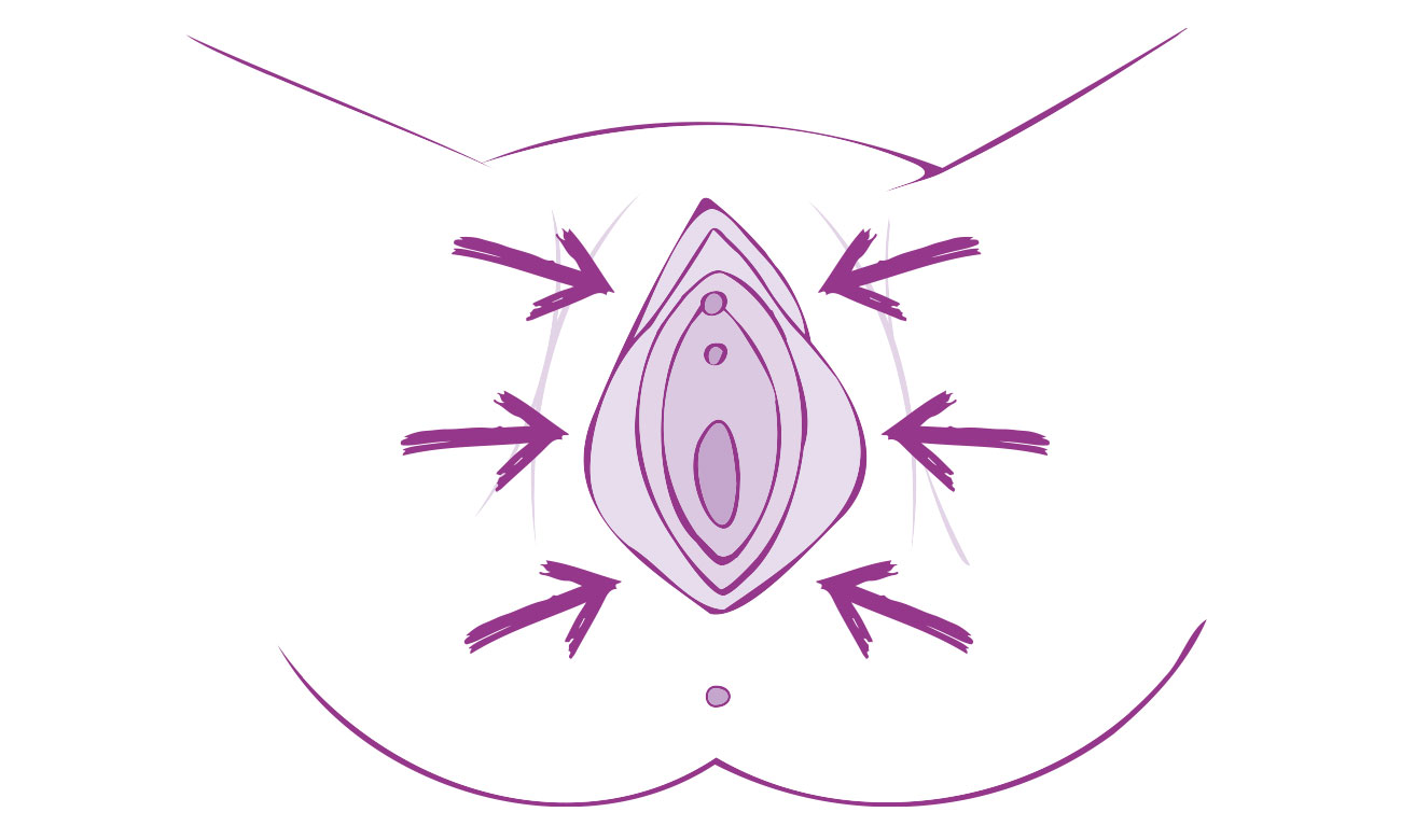 ESWT non invasive pour le CPPS chez la femme : soulagement efficace de la vulvodynie et de la dyspareunie.
